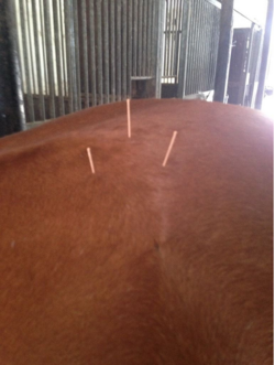 Dry needling