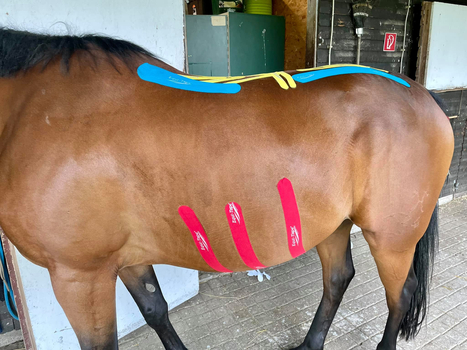 Kinesiologisches Taping